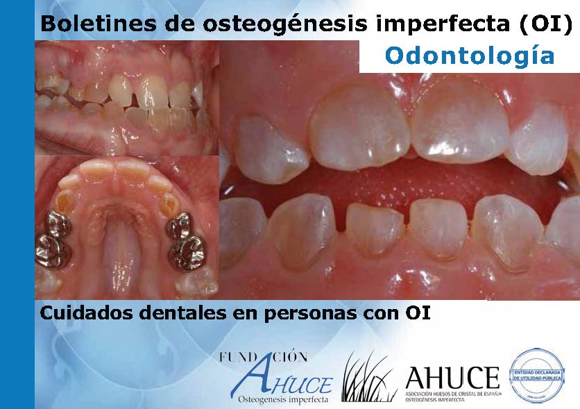 Odontología OI