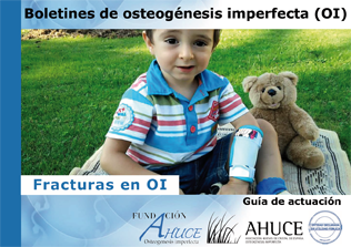 Fracturas en Osteogénesis imperfecta